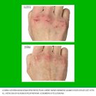 O’Keeffe’s Working Hands kézkrém használata előtte és utána – repedezett kézbőr javulása