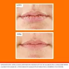 Előtte és utána fotó az ajkakról az O’Keeffe’s Lip Repair ajakbalzsam használata után