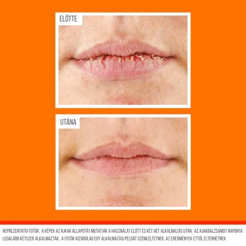 Előtte és utána eredményfotó az O’Keeffe’s Lip Repair cooling ajakbalzsam használata után száraz, kicserepesedett ajkakon