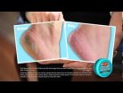 OKeeffes for Healthy Feet Tube lábápoló krém 85g